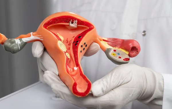 Pelvic Floor Repair for Uterine Prolapse